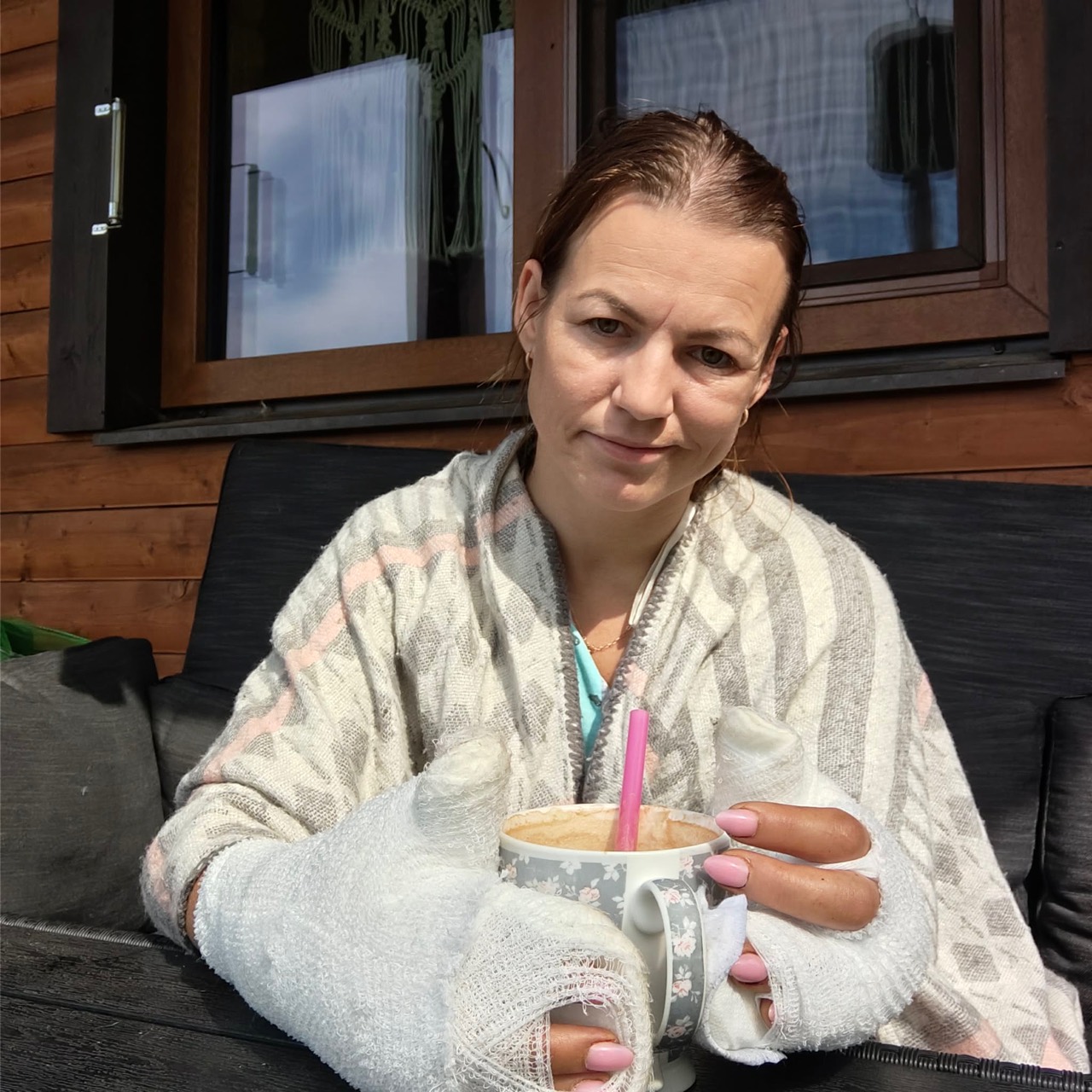 Evvu istumas õues kohvitassiga, milles on kõrs; mõlemad käed on tugevalt sidemetes.