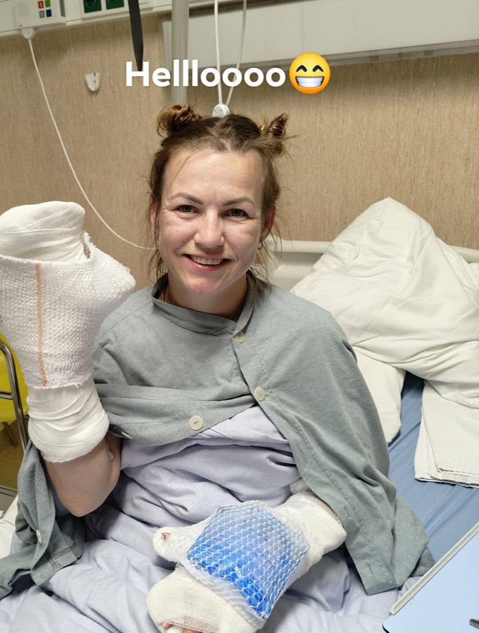 Evvu istumas haiglavoodil, mõlemad käed sidemetes.